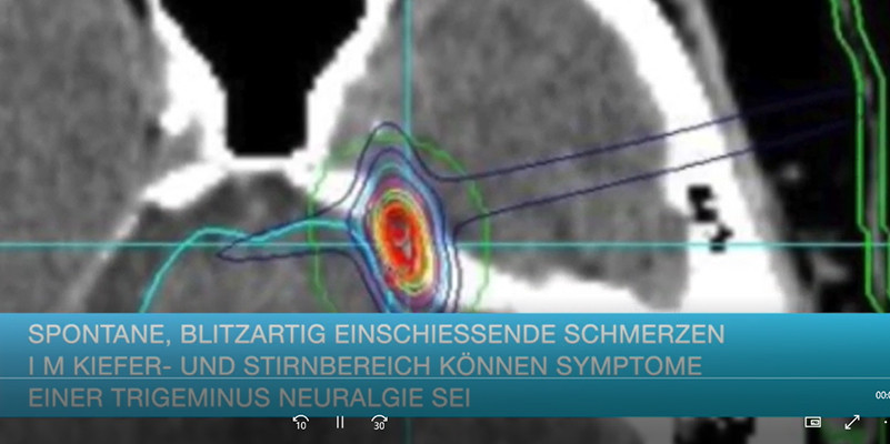 Screenshot-Trigeminus-Neuralgie-NC-YouTube
